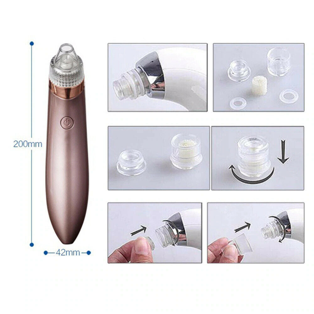Electric Blackhead & Pore Vacuum Cleaner – Strong Suction Acne & Pimple Remover with Diamond Dermabrasion for Facial Skin Care