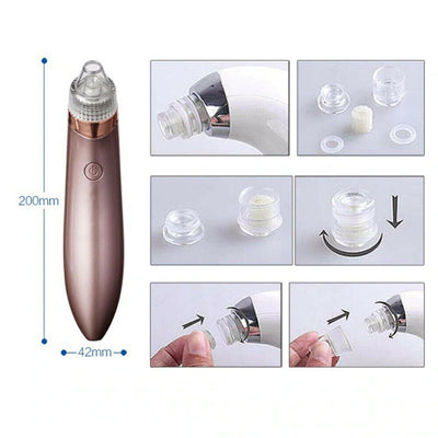 Electric Blackhead & Pore Vacuum Cleaner – Strong Suction Acne & Pimple Remover with Diamond Dermabrasion for Facial Skin Care