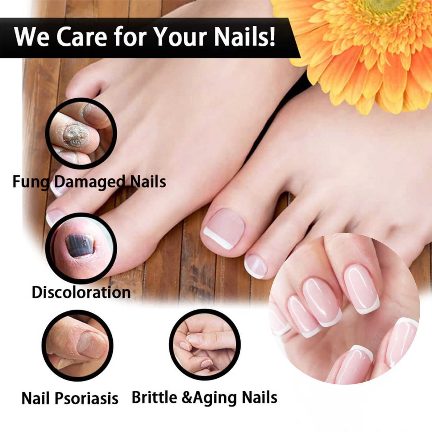 EELHOE Nail Repair & Care Solution – Strengthen, Brighten & Nourish Nails