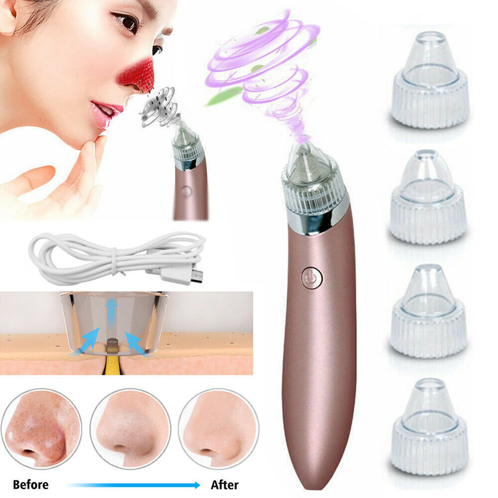 Electric Blackhead & Pore Vacuum Cleaner – Strong Suction Acne & Pimple Remover with Diamond Dermabrasion for Facial Skin Care