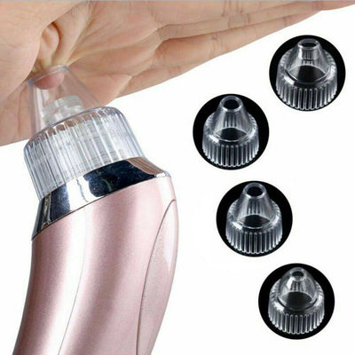 Electric Blackhead & Pore Vacuum Cleaner – Strong Suction Acne & Pimple Remover with Diamond Dermabrasion for Facial Skin Care